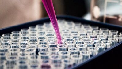 Come fare test per riconoscere i parassiti nel corpo